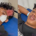 Korban Pembusuran di Jalan Landak Kota Makassar Remaja Tertancap Busur di Bagian Pipi