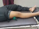 Pelajar di Takalar Jadi Korban Busur, Paha Tertancap Anak Panah