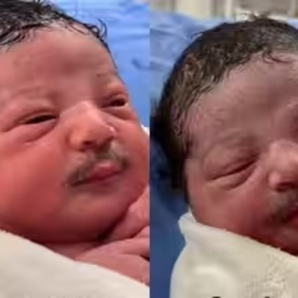 Video Bayi Berkumis Tebal Viral, Pakar: Diduga Manipulasi Digital Bukan Lanugo