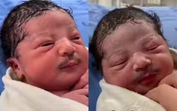Video Bayi Berkumis Tebal Viral, Pakar: Diduga Manipulasi Digital Bukan Lanugo
