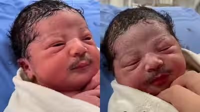 Video Bayi Berkumis Tebal Viral, Pakar: Diduga Manipulasi Digital Bukan Lanugo 1 Video Bayi Berkumis Tebal Viral, Pakar: Diduga Manipulasi Digital Bukan Lanugo